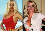 Around the World Social Event Celebrity plastic surgery before and after Lebanon